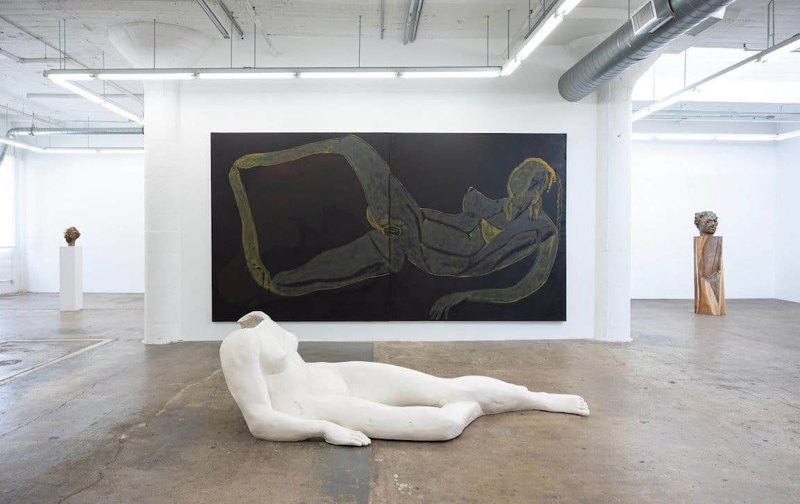 Vanessa Beecroft — Broken Arm — image 1 of 3
