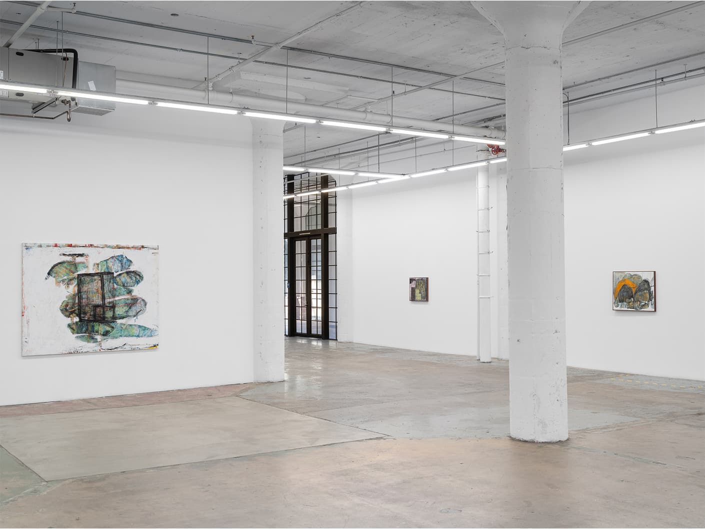 June Canedo de Souza — All Top Teeth Knocked Out at Once — image 1 of 3
