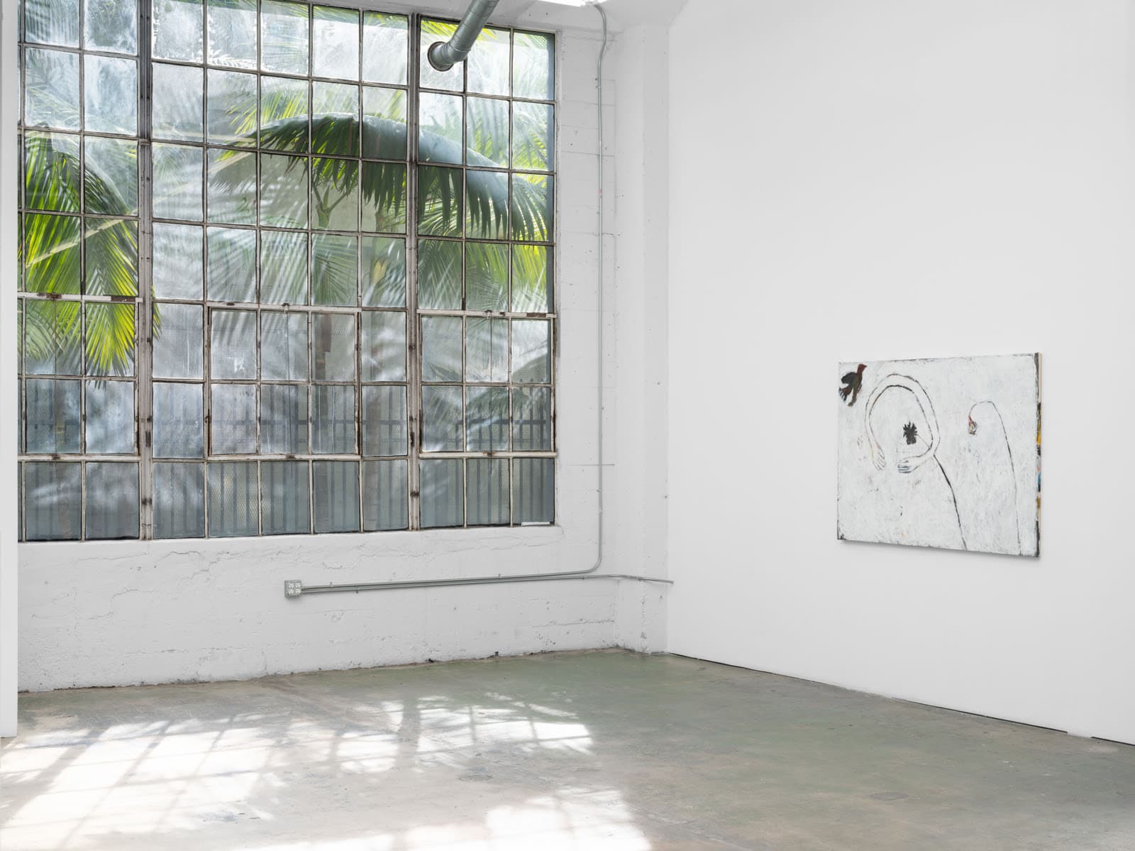 June Canedo de Souza — All Top Teeth Knocked Out at Once — image 3 of 3